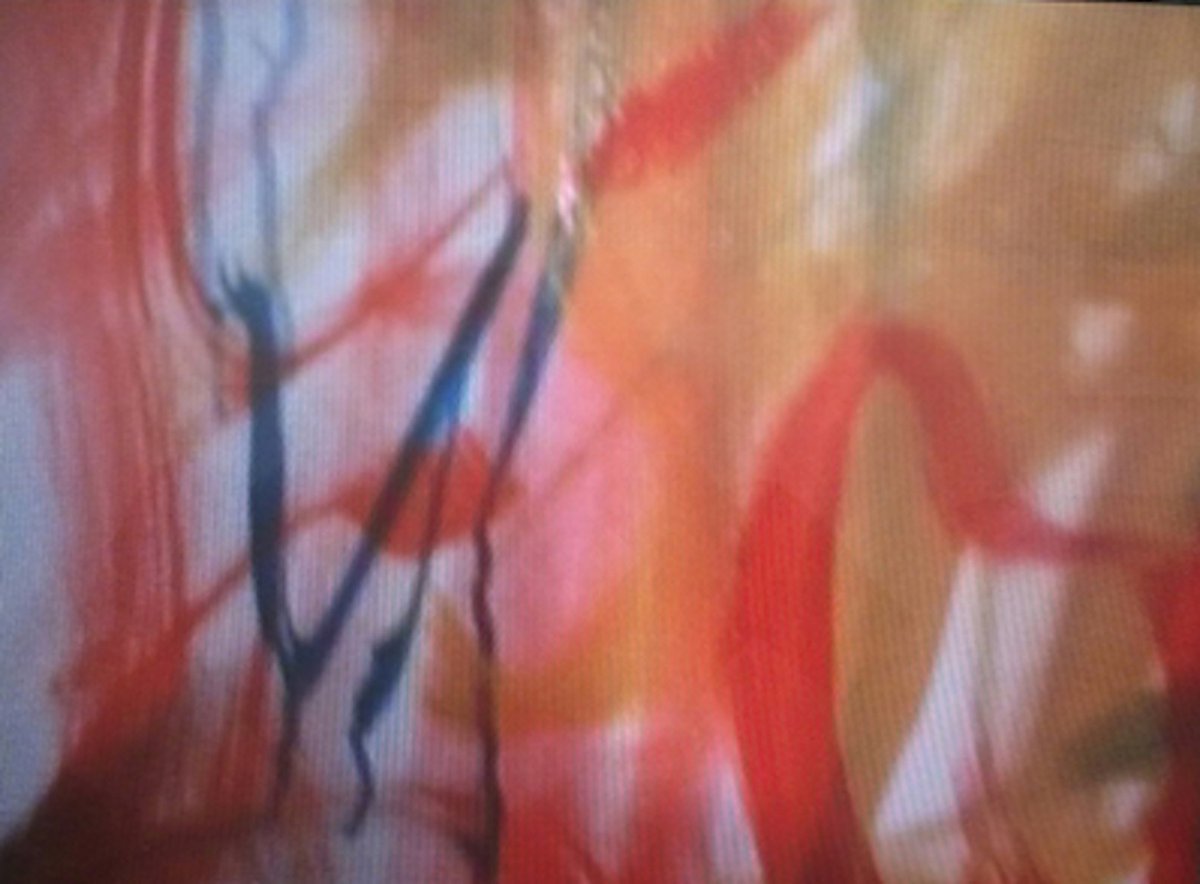 Margaret RaspéGelb, Rot und Blau entgegen (Towards Yellow, Red and Blue), 1983Super 8 transferred to blu-ray, color, silent00:28:00